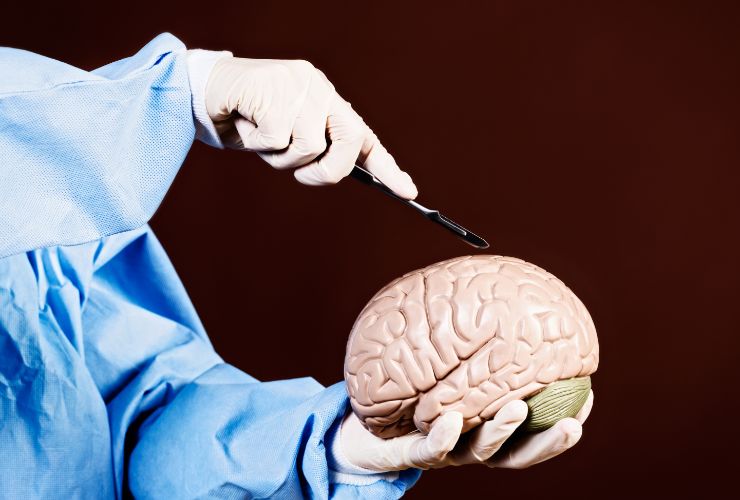 chirurgo con in mano un cervello finto