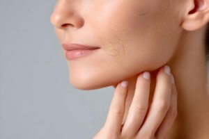 Primo piano viso, pelle secca e screpolata