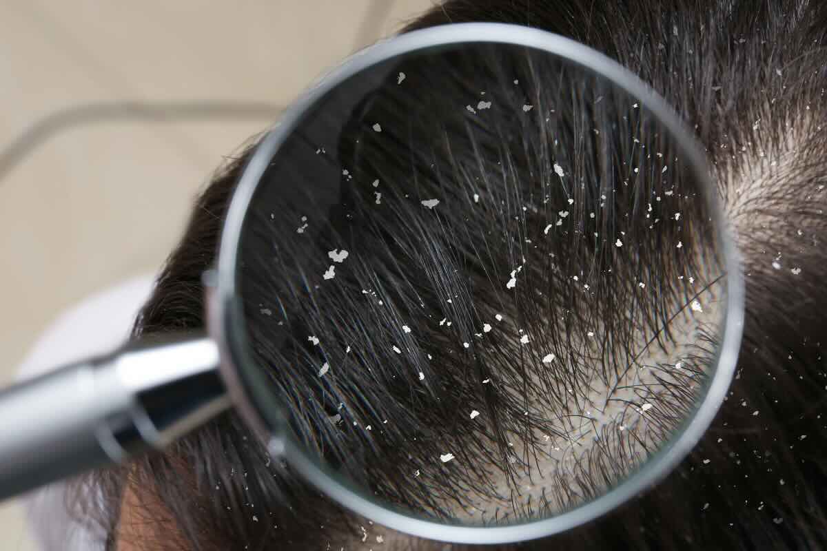 forfora lente di ingrandimento