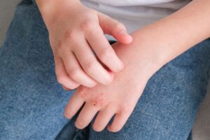 uomo che si gratta le mani