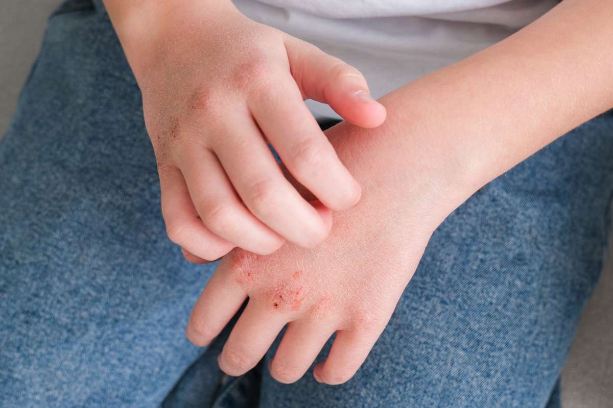 uomo che si gratta le mani